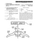 System and Method for Correcting Higher Order Aberrations with Changes in     Intrastromal Biomechanical Stress Distributions diagram and image