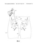 SYSTEMS AND METHODS FOR TREATMENT OF PREMENSTRUAL DYSPHORIC DISORDERS diagram and image