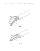 Endoscopic Vessel Sealer and Divider for Large Tissue Structures diagram and image