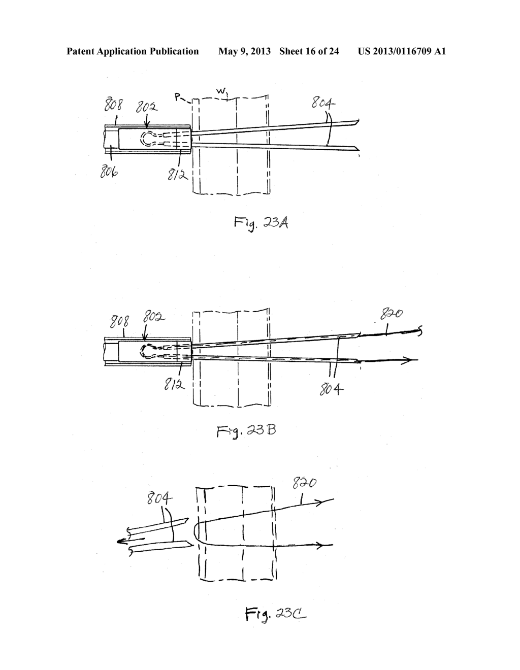 INSTRUMENTS FOR DELIVERING TRANSFASCIAL SUTURES AND METHODS OF     TRANSFASCIAL SUTURING - diagram, schematic, and image 17