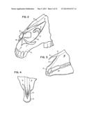 Nasal Support Device and Method diagram and image