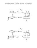 Nasal Support Device and Method diagram and image