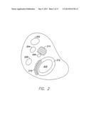 SINGLE CHAMBER LEADLESS INTRA-CARDIAC MEDICAL DEVICE WITH DUAL-CHAMBER     FUNCTIONALITY diagram and image