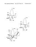 SINGLE CHAMBER LEADLESS INTRA-CARDIAC MEDICAL DEVICE WITH DUAL-CHAMBER     FUNCTIONALITY diagram and image