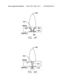 SINGLE CHAMBER LEADLESS INTRA-CARDIAC MEDICAL DEVICE WITH DUAL-CHAMBER     FUNCTIONALITY diagram and image