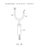 SINGLE CHAMBER LEADLESS INTRA-CARDIAC MEDICAL DEVICE WITH DUAL-CHAMBER     FUNCTIONALITY diagram and image