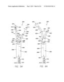 SINGLE-CHAMBER LEADLESS INTRA-CARDIAC MEDICAL DEVICE WITH DUAL-CHAMBER     FUNCTIONALITY AND SHAPED STABILIZATION INTRA-CARDIAC EXTENSION diagram and image