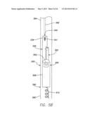 SINGLE-CHAMBER LEADLESS INTRA-CARDIAC MEDICAL DEVICE WITH DUAL-CHAMBER     FUNCTIONALITY AND SHAPED STABILIZATION INTRA-CARDIAC EXTENSION diagram and image