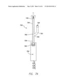 SINGLE-CHAMBER LEADLESS INTRA-CARDIAC MEDICAL DEVICE WITH DUAL-CHAMBER     FUNCTIONALITY AND SHAPED STABILIZATION INTRA-CARDIAC EXTENSION diagram and image