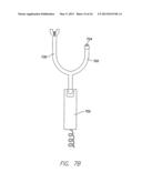 SINGLE-CHAMBER LEADLESS INTRA-CARDIAC MEDICAL DEVICE WITH DUAL-CHAMBER     FUNCTIONALITY AND SHAPED STABILIZATION INTRA-CARDIAC EXTENSION diagram and image