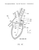 SINGLE-CHAMBER LEADLESS INTRA-CARDIAC MEDICAL DEVICE WITH DUAL-CHAMBER     FUNCTIONALITY AND SHAPED STABILIZATION INTRA-CARDIAC EXTENSION diagram and image