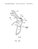 SINGLE-CHAMBER LEADLESS INTRA-CARDIAC MEDICAL DEVICE WITH DUAL-CHAMBER     FUNCTIONALITY AND SHAPED STABILIZATION INTRA-CARDIAC EXTENSION diagram and image