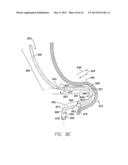 SINGLE-CHAMBER LEADLESS INTRA-CARDIAC MEDICAL DEVICE WITH DUAL-CHAMBER     FUNCTIONALITY AND SHAPED STABILIZATION INTRA-CARDIAC EXTENSION diagram and image