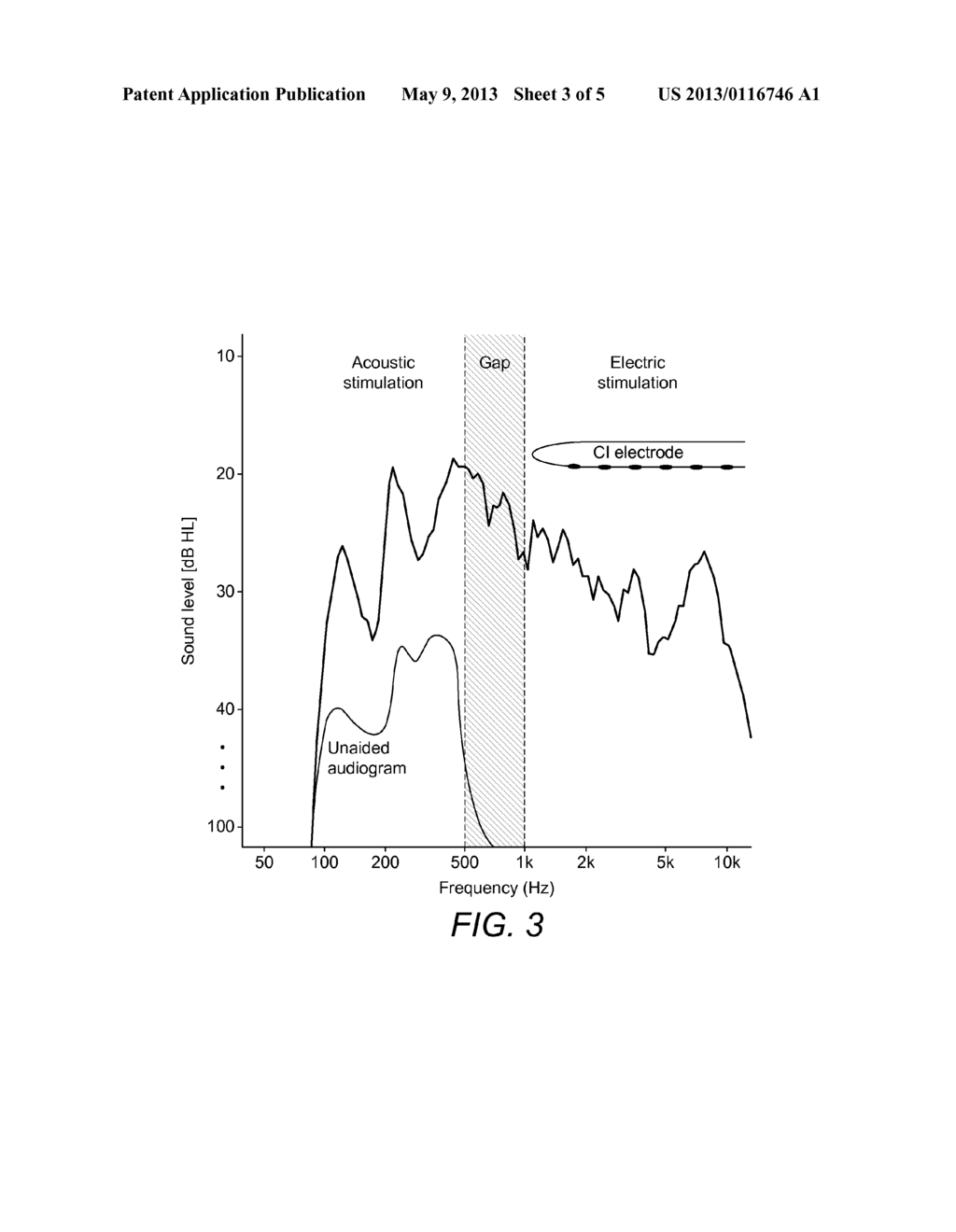 Transpositional Acoustic Frequency Range In EAS Patients - diagram, schematic, and image 04