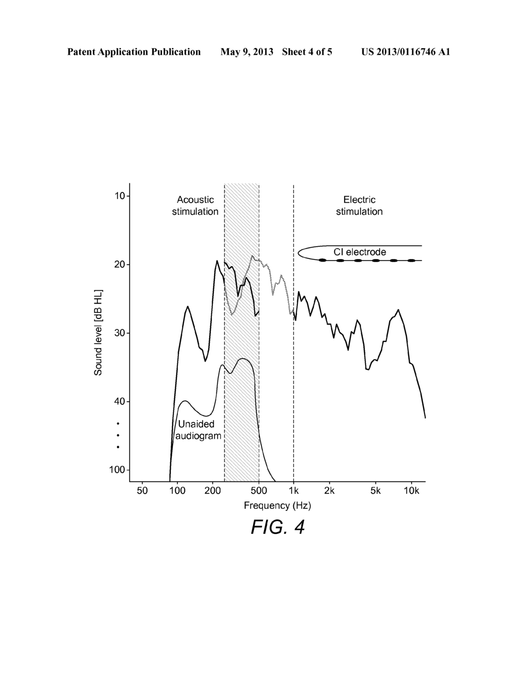 Transpositional Acoustic Frequency Range In EAS Patients - diagram, schematic, and image 05