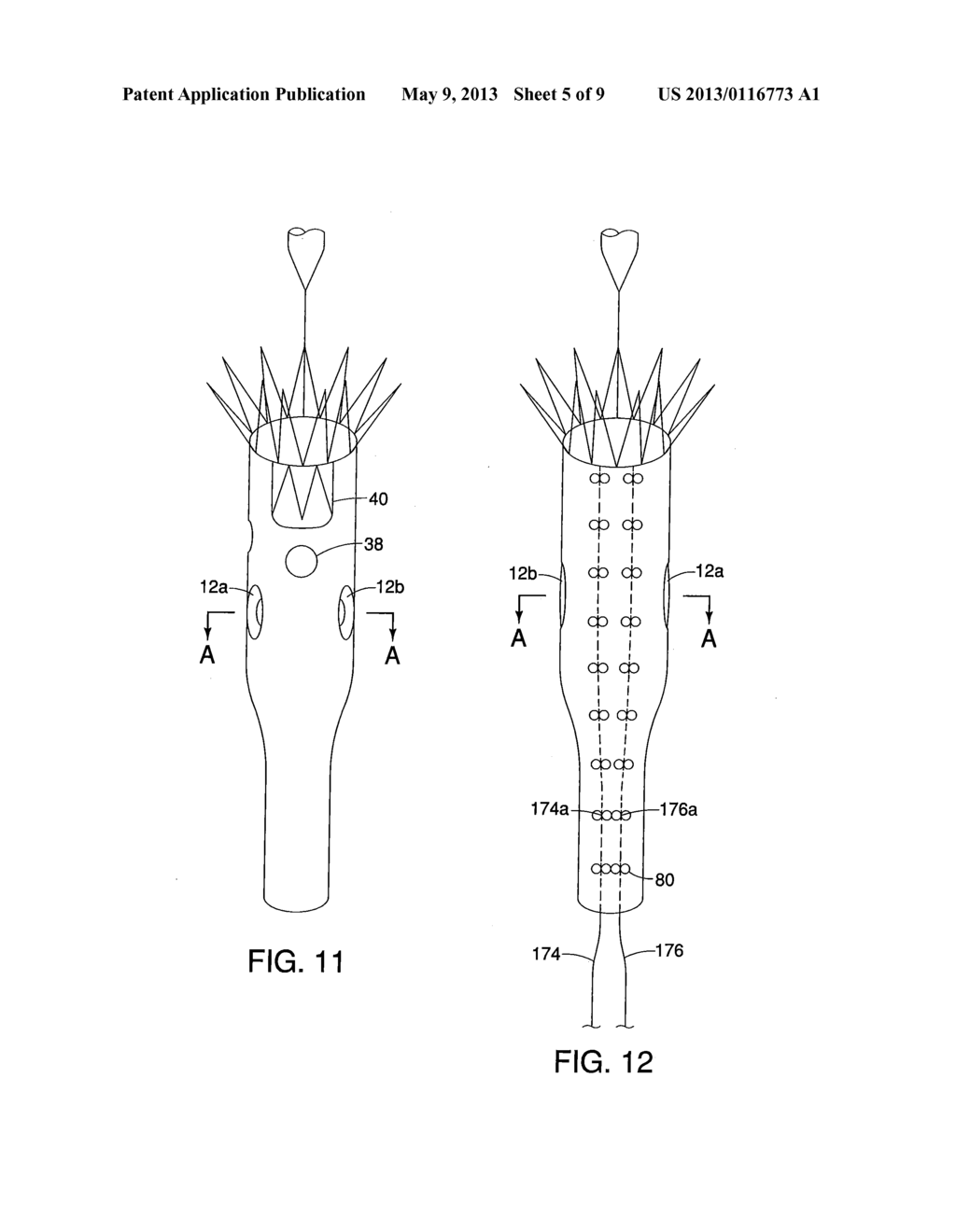 DIAMETER REDUCING TIE ARRANGEMENT FOR ENDOLUMINAL PROSTHESIS - diagram, schematic, and image 06