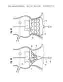 UNITARY QUICK-CONNECT PROSTHETIC HEART VALVEAND DEPLOYMENT SYSTEM AND     METHODS diagram and image