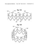 UNITARY QUICK-CONNECT PROSTHETIC HEART VALVEAND DEPLOYMENT SYSTEM AND     METHODS diagram and image