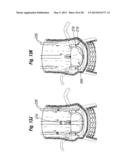 UNITARY QUICK-CONNECT PROSTHETIC HEART VALVEAND DEPLOYMENT SYSTEM AND     METHODS diagram and image