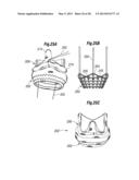 UNITARY QUICK-CONNECT PROSTHETIC HEART VALVEAND DEPLOYMENT SYSTEM AND     METHODS diagram and image