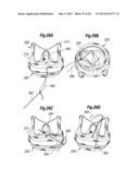 UNITARY QUICK-CONNECT PROSTHETIC HEART VALVEAND DEPLOYMENT SYSTEM AND     METHODS diagram and image