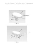 PARTIAL JOINT RESURFACING IMPLANT, INSTRUMENTATION, AND METHOD diagram and image