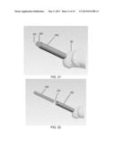 PARTIAL JOINT RESURFACING IMPLANT, INSTRUMENTATION, AND METHOD diagram and image