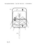 Sugar cane harvester automatic cutter height control diagram and image