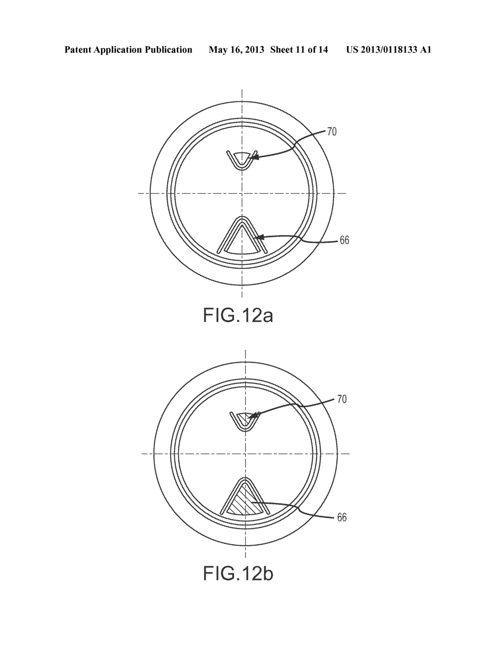 Vented Metallic Container End Closure - diagram, schematic, and image 12