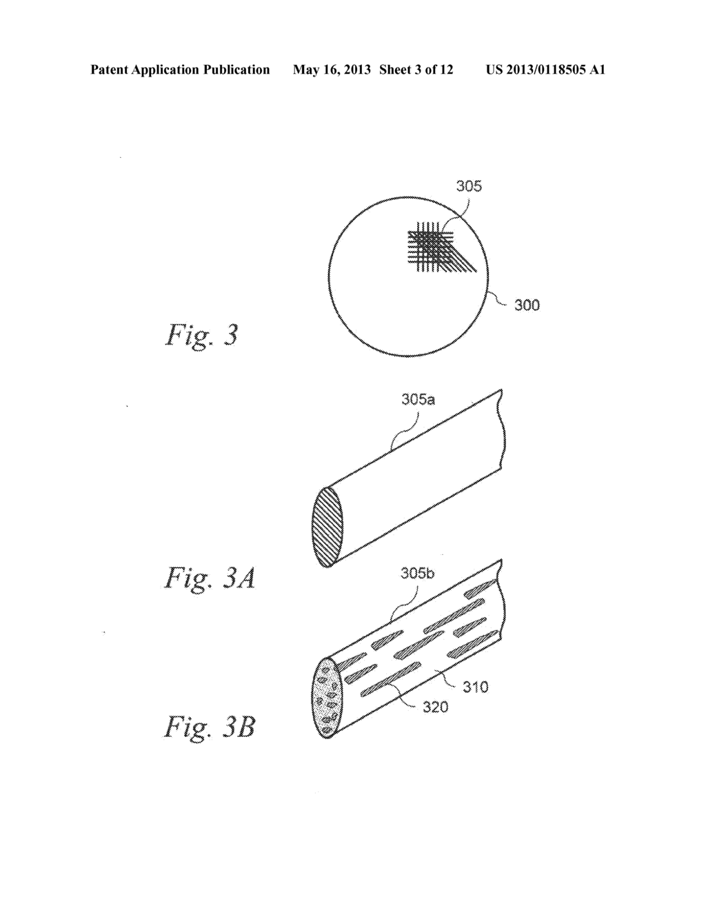 MAGNETIC IMPLANTS AND METHODS FOR TREATING AN OROPHARYNGEAL CONDITION - diagram, schematic, and image 04