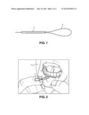 Method of Implant Flossing diagram and image