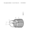 DUAL STERILIZATION CONTAINMENT VESSEL diagram and image