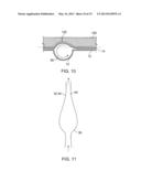 Dialysis Fluid Cassettes and Related Systems and Methods diagram and image