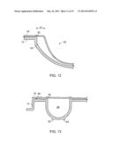 Dialysis Fluid Cassettes and Related Systems and Methods diagram and image