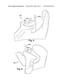 METHOD AND SYSTEM FOR PRODUCING AT LEAST ONE PATIENT-SPECIFIC SURGICAL AID diagram and image