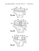 METHOD AND SYSTEM FOR PRODUCING AT LEAST ONE PATIENT-SPECIFIC SURGICAL AID diagram and image