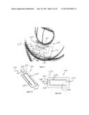 LAMP PART FIXING BY SHAPE MEMORY ALLOY IN THE DISCHARGE TUBE OF     FLUORESCENT LAMPS diagram and image