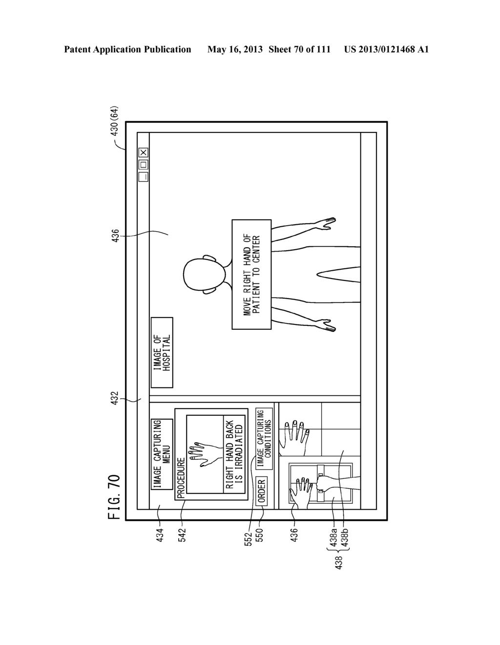 RADIOGRAPH IMAGING SYSTEM, RADIOGRAPH IMAGING METHOD, AND IMAGE DISPLAY     METHOD - diagram, schematic, and image 71