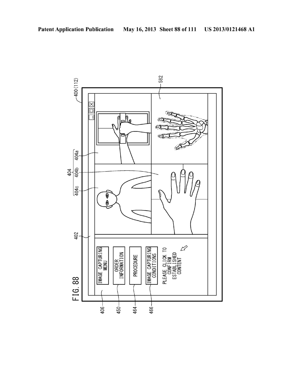 RADIOGRAPH IMAGING SYSTEM, RADIOGRAPH IMAGING METHOD, AND IMAGE DISPLAY     METHOD - diagram, schematic, and image 89