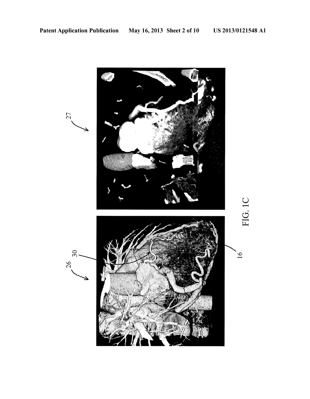 ADAPTIVE VISUALIZATION FOR DIRECT PHYSICIAN USE - diagram, schematic, and image 03