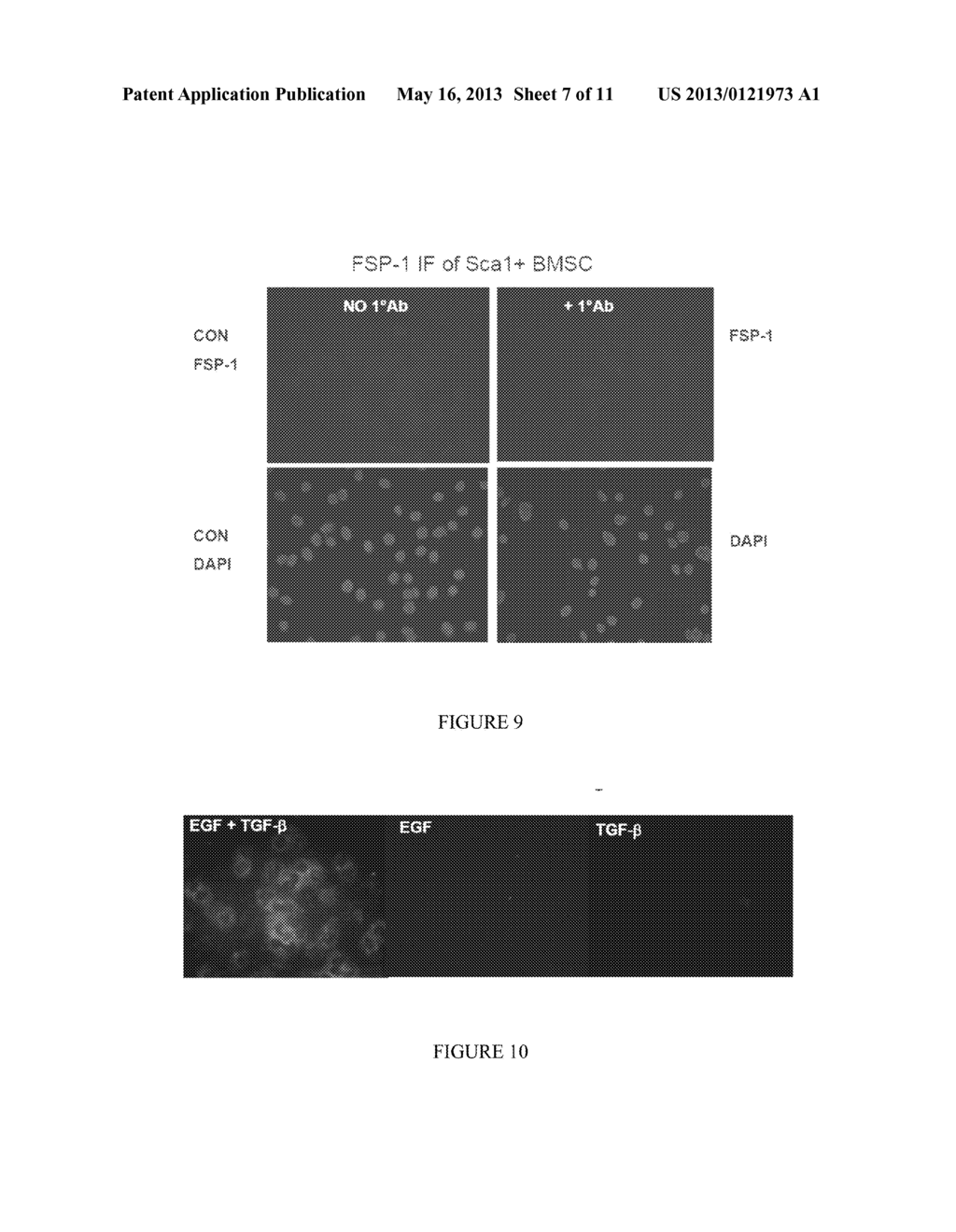 DIFFERENTIATION OF MESENCHYMAL STEM CELLS INTO FIBROBLASTS, COMPOSITIONS     COMPRISING MESENCHYMAL STEM CELL-DERIVED FIBROBLASTS, AND METHODS OF     USING THE SAME - diagram, schematic, and image 08