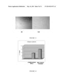 DIFFERENTIATION OF MESENCHYMAL STEM CELLS INTO FIBROBLASTS, COMPOSITIONS     COMPRISING MESENCHYMAL STEM CELL-DERIVED FIBROBLASTS, AND METHODS OF     USING THE SAME diagram and image