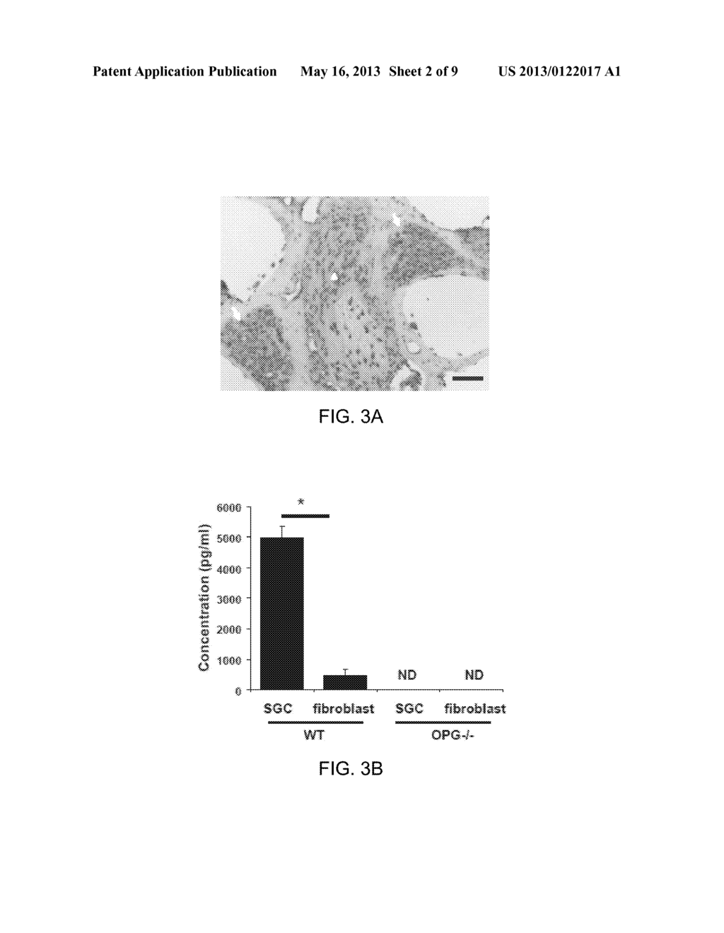 Osteoprotegerin in Neuroprotection - diagram, schematic, and image 03