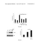 Osteoprotegerin in Neuroprotection diagram and image