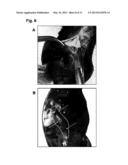 COLLAGEN-CONTAINING CELL CARRIER diagram and image