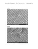 PLATELET-DERIVED GROWTH FACTOR COMPOSITIONS AND METHODS FOR THE TREATMENT     OF OSTEOCHONDRAL DEFECTS diagram and image