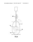 METHOD OF PREPARING A TUBER diagram and image