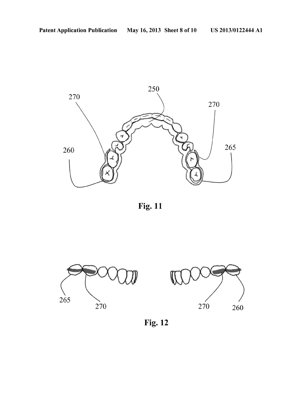 Dental Retainer Having Improved Joint With Labial Bow - diagram, schematic, and image 09