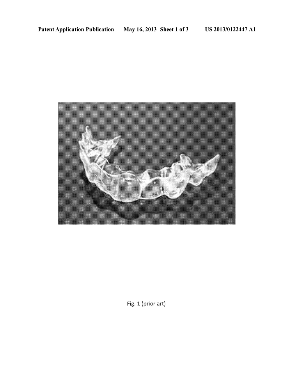 Method for Making and Using Aligners for Orthodontic Treatments - diagram, schematic, and image 02