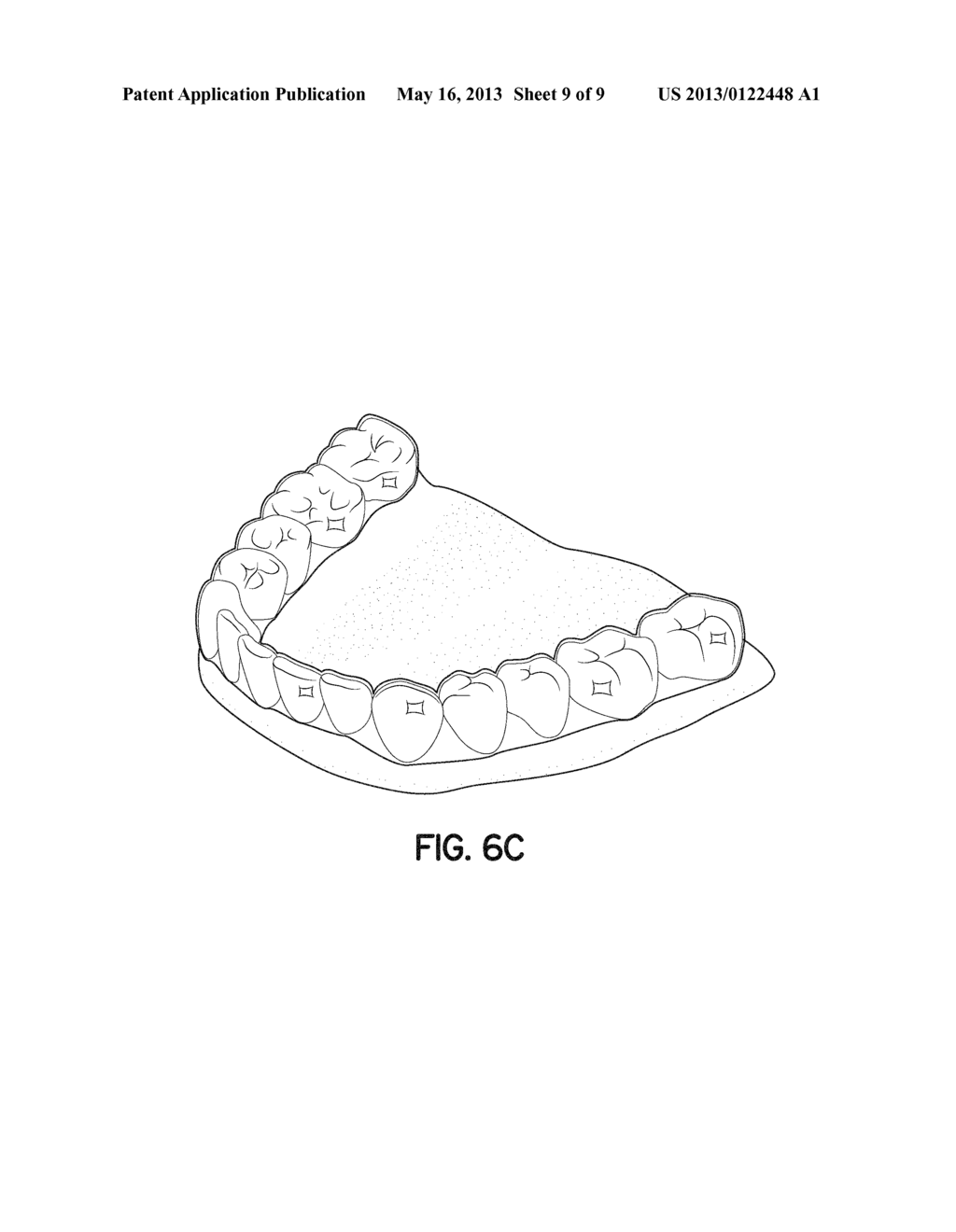 DIRECT MANUFACTURE OF ORTHODONTIC ALIGNER APPLIANCE - diagram, schematic, and image 10